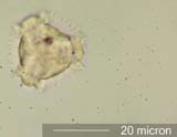 Dandelion (Taraxacum officinale) Pollen