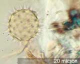 Triporate Pollen