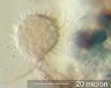 Triporate Pollen