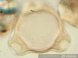 Triporate Pollen