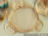 Triporate Pollen