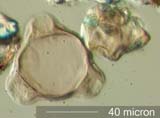 Triporate Pollen