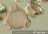 Triporate Pollen