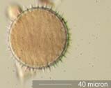 Periporate Pollen
