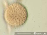 Periporate Pollen