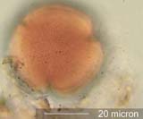 Tricolporate Pollen