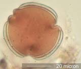 Tricolporate Pollen