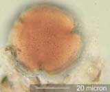 Washington State Honey Pollen Under the Microscope