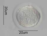 Western Red Alder Pollen