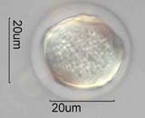 Western Red Alder Pollen