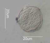 Western Red Alder Pollen