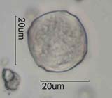 Western Red Alder Pollen