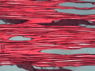 Populus balsamifera, Tangential-Section