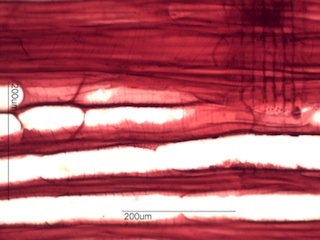 Prunus serotina, Radial Section