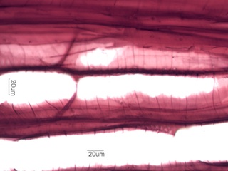 Prunus serotina, Radial Section