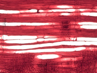 Prunus serotina, Radial Section