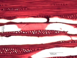 Prunus serotina, Tangential Section