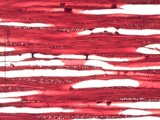 Prunus serotina, Tangential Section