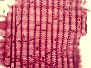 Pseudotsuga Menziesii, Radial-Section