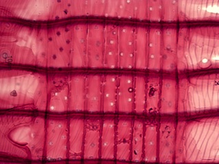 Pseudotsuga Menziesii, Radial-Section