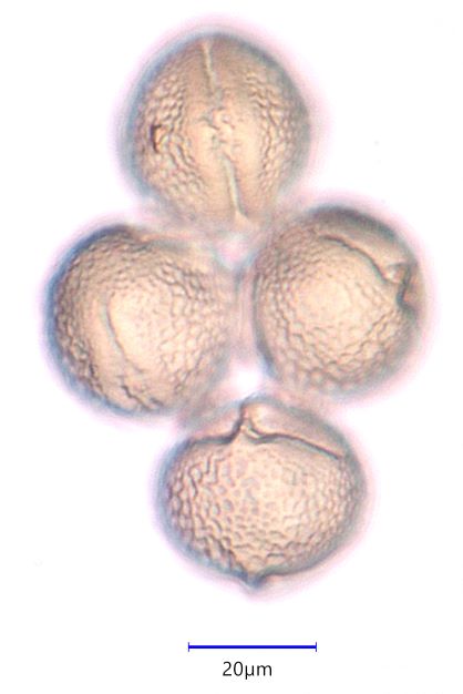 Red Clover (Trifolium pretense) Pollen Under the Microscope