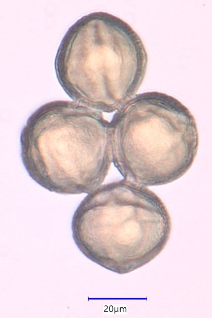 Red Clover (Trifolium pretense) Pollen Under the Microscope