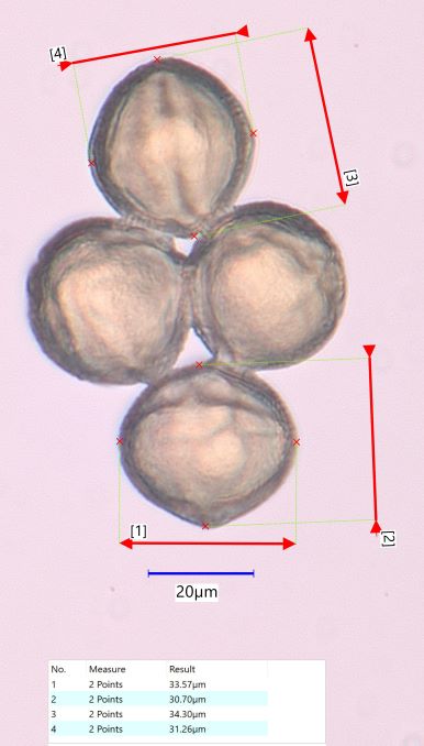 Red Clover (Trifolium pretense) Pollen Under the Microscope