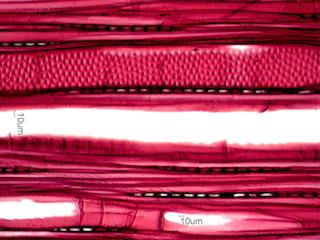 Populus tremuloides, Tangential Section