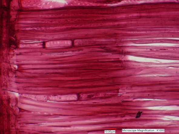 Quercus alba, Radial Section