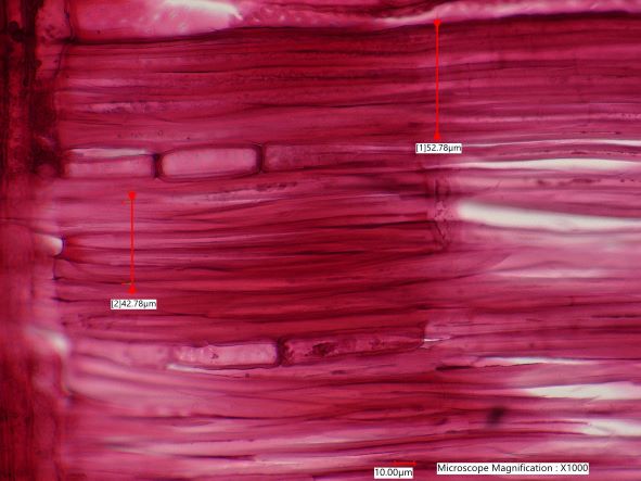 Quercus alba, Radial Section