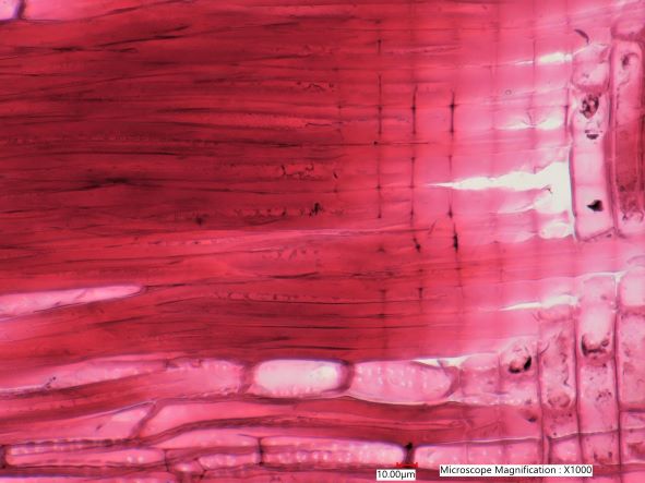 Quercus rubra, Radial-Section