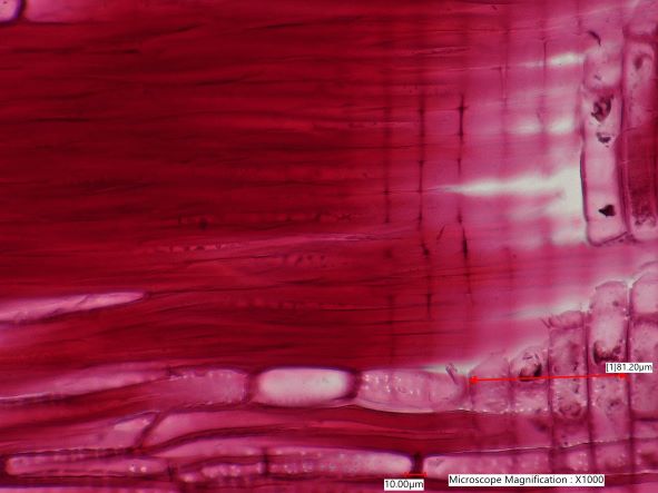 Quercus rubra, Radial-Section