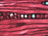 Quercus alba, Tangential-Section