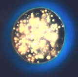 Glass Sphere in Matching RI Liquid, Dark Field