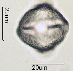 Red Clover (Trifolium pretense) Pollen