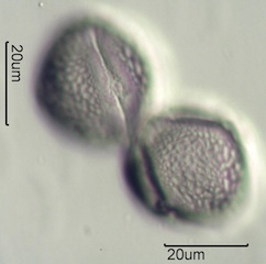 Red Clover (Trifolium pretense) Pollen