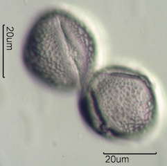 Red Clover (Trifolium pretense) Pollen