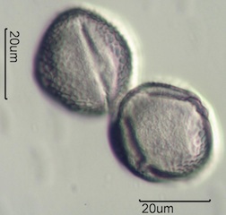 Red Clover (Trifolium pretense) Pollen