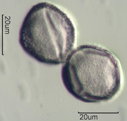 Red Clover (Trifolium pretense) Pollen