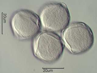 Red Clover (Trifolium pretense) Pollen