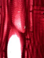 Quercus rubra, Radial-Section