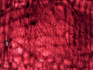 Quercus rubra, Radial-Section