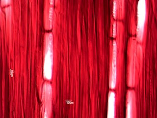 Quercus rubra, Radial-Section