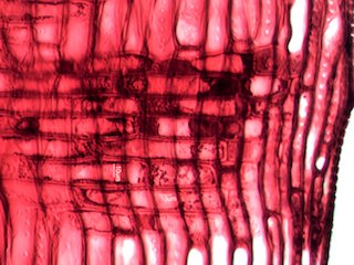 Quercus rubra, Radial-Section