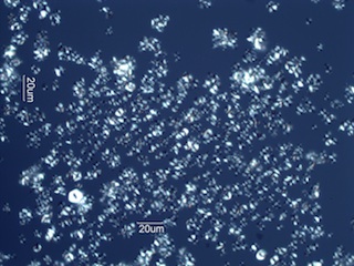 Rice Starch Under the Microscope