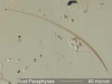 Paraphyses