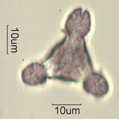 Pollen from Swedish Honey Under the Microscope