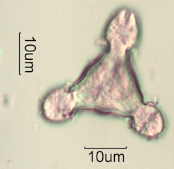 Pollen from Swedish Honey Under the Microscope