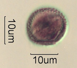 Pollen from Swedish Honey Under the Microscope