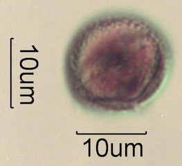 Pollen from Swedish Honey Under the Microscope